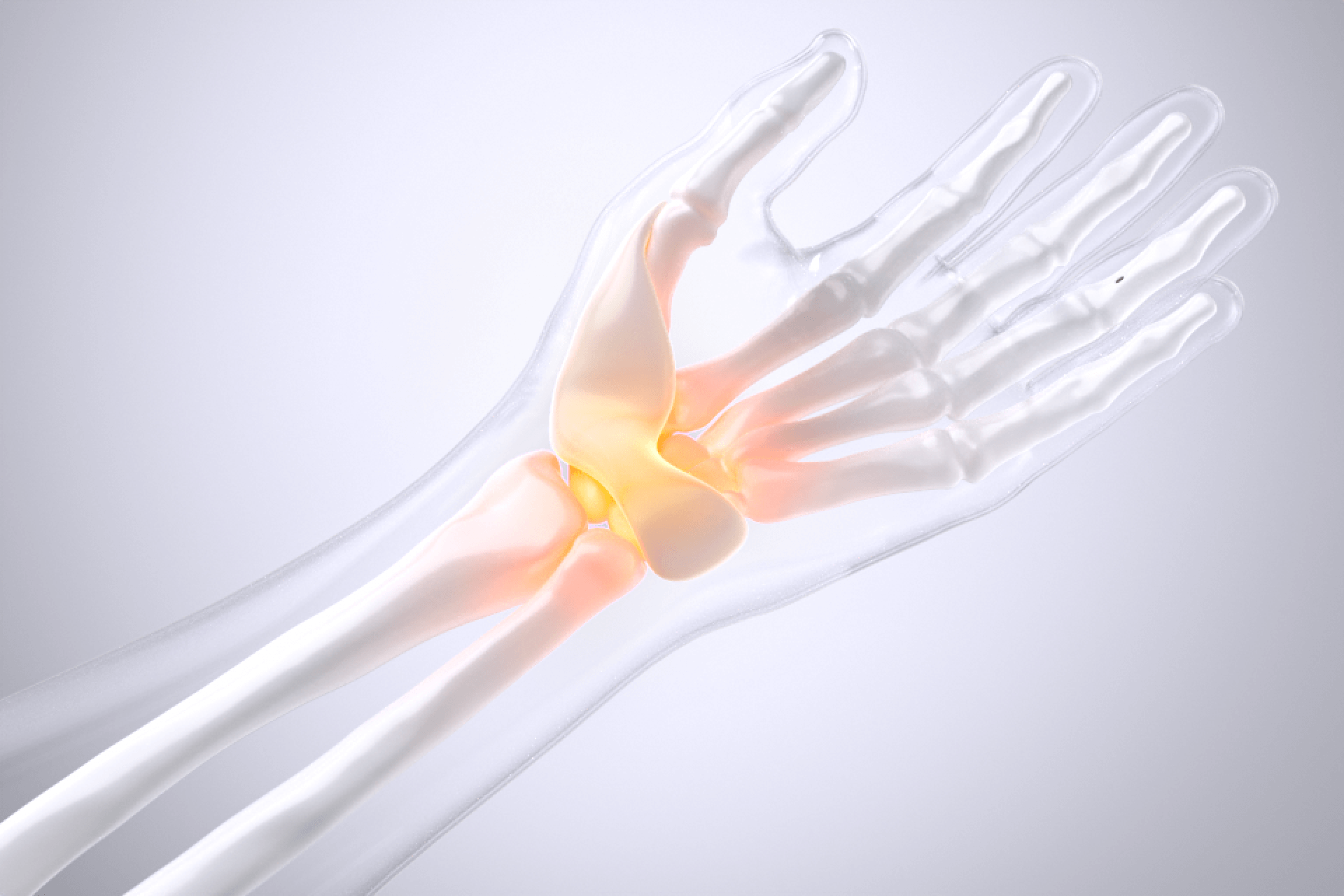 손목터널증후군 설명 영상