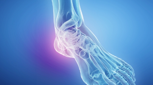 발꿈치 안쪽 통증