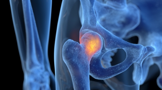 통증으로 인한 절뚝거림