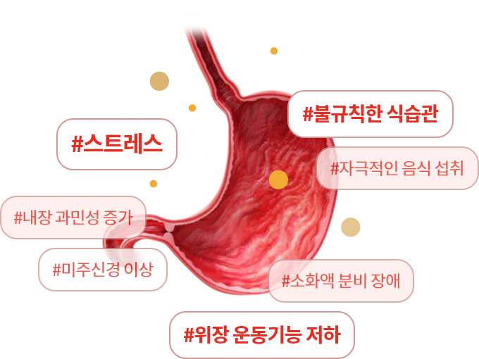 #스트레스 #불규칙한 식습관 #자극적이 음식섭취 #소화액 분비 장애 #위장 운동기능 저하 #미주신경이상 #내장 과민성 증가