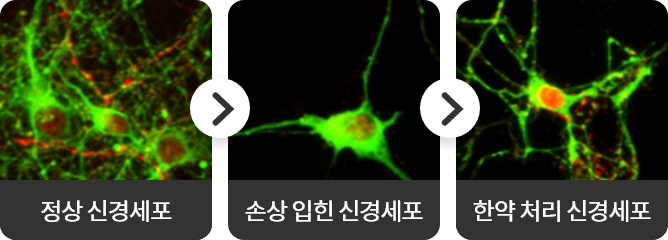 정상 신경세표 손상을 입힌 신경세포 와사해표탕 처리 신경세표