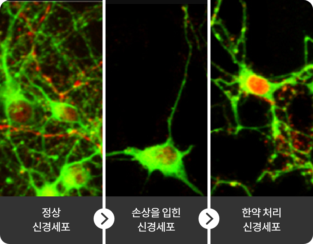 정상 신경세표 손상을 입힌 신경세포 와사해표탕 처리 신경세표